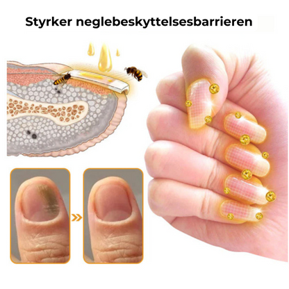 Negleskjold™ | Stop ødelagte negle for altid