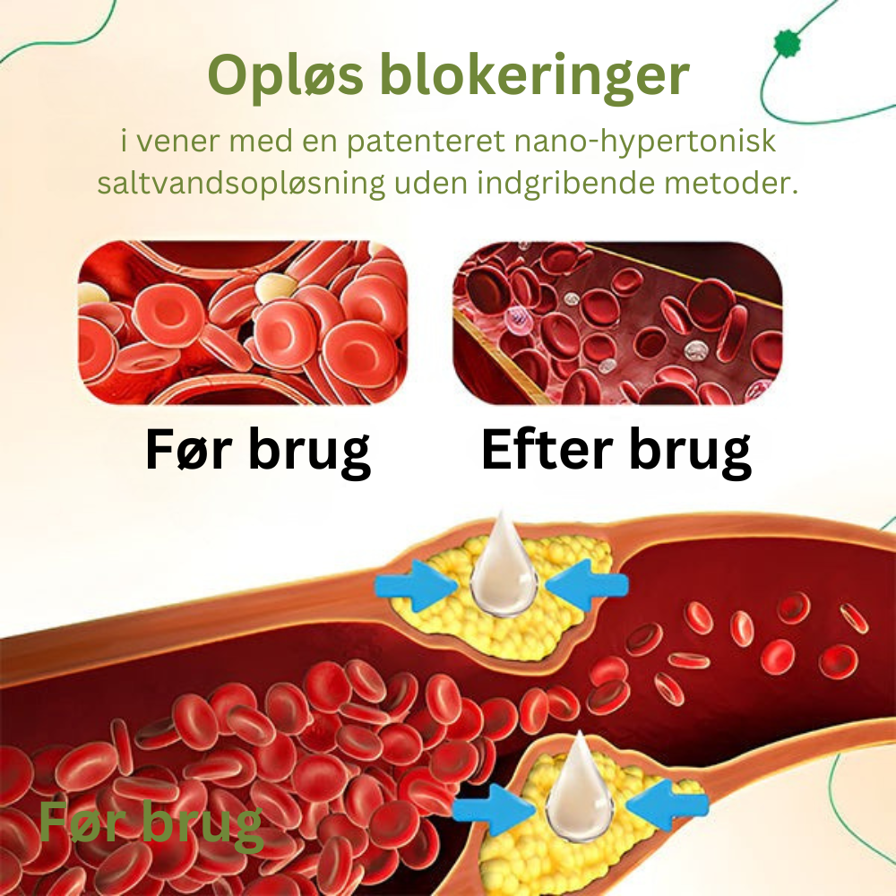 VeneRehab™ | Garanteret glattere og sundere ben