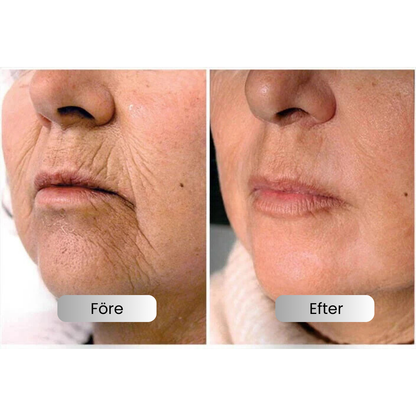 DermaTight™ | Wrinkle-free skin in just minutes!